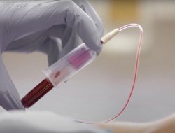 Guardant Health Liquid Biopsy Revolutionizing Cancer Detection